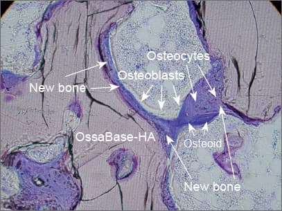 Histologischer Schnitt: OssaBase-HA mit neu gebildetem Knochen