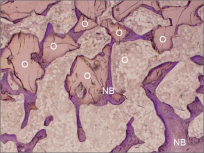 Histologischer Schnitt: Porenstruktur von OssaBase-HA